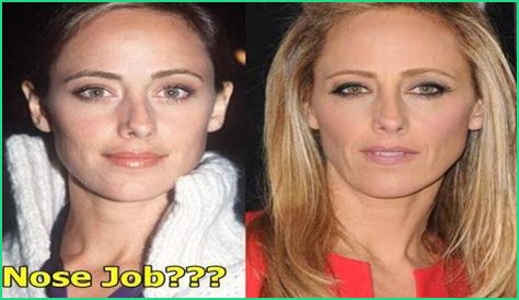 Kim Raver Plastic Surgery Before and After